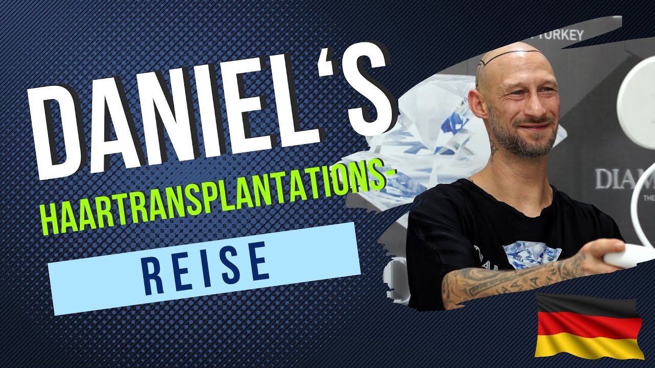 DANIEL'S HAARTRANSPLANTATIONS- REISE/AUS DEUTSCHLAND