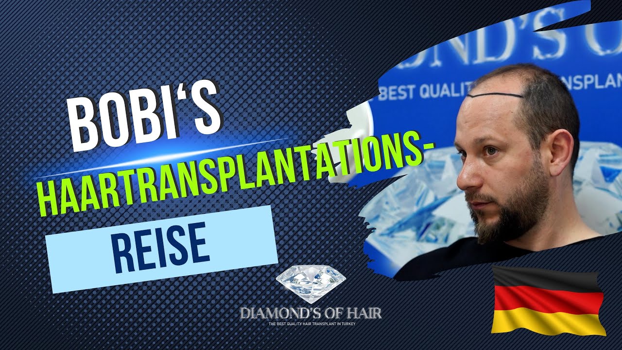 VIKTOR'S HAARTRANSPLANTATIONS- REISE/AUS DEUTSCHLAND