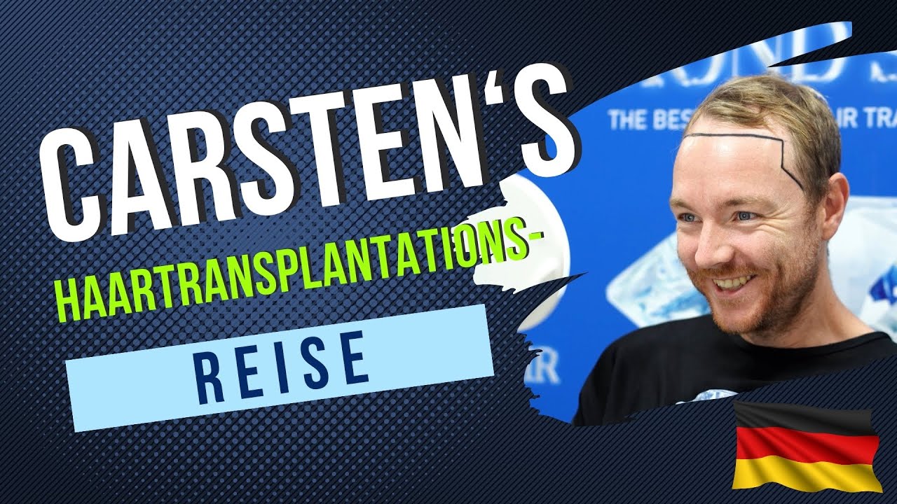 CARSTEN'S HAARTRANSPLANTATIONS- REISE/AUS DEUTSCHLAND