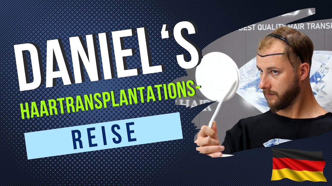 DANIEL'S HAARTRANSPLANTATIONS- REISE/AUS DEUTSCHLAND