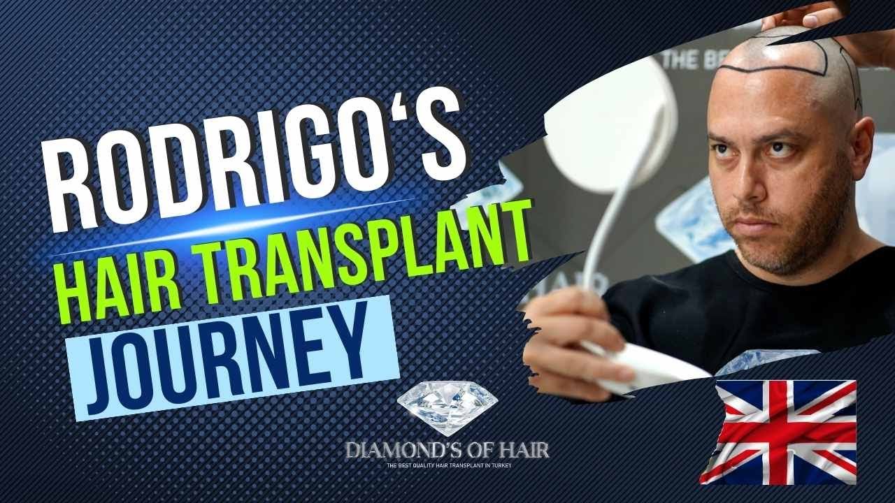 RODRIGO'S HAIR TRANSPLANTATION JOURNEY